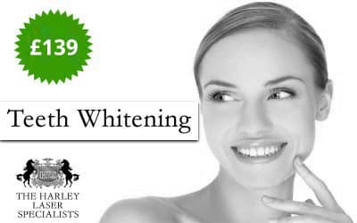 London Teeth Whitening Special Offer