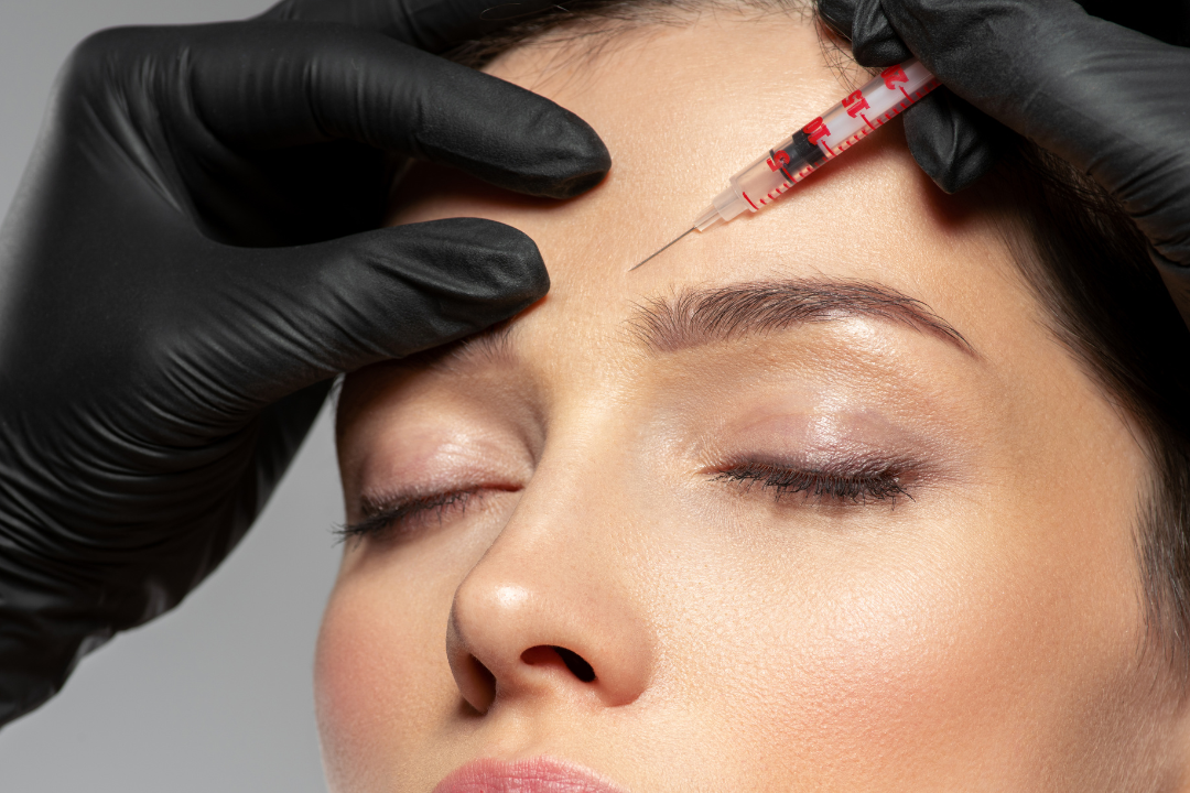 botox