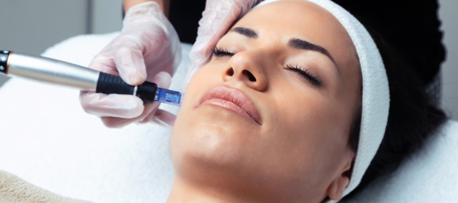 dermapen